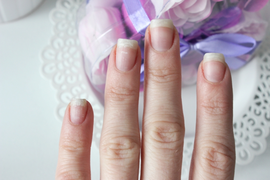 How to repair nails damaged by gel manicure? Top home remedies